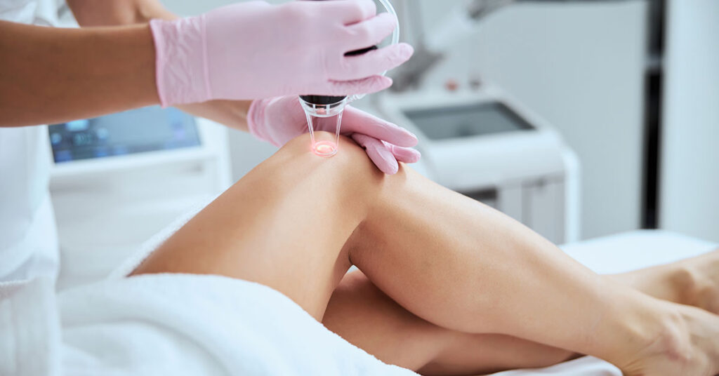 EscleroLaser (Laser Transdérmico)